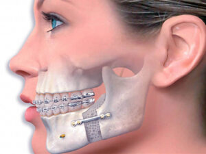 Экспертиза челюстно-лицевой хирургии